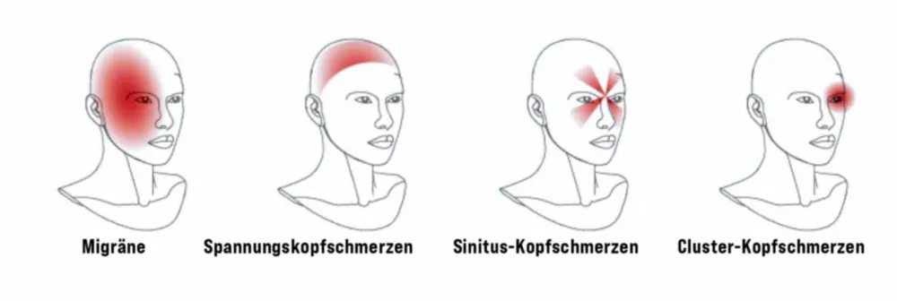 Tipos de dolor de cabeza que dañan el cuello